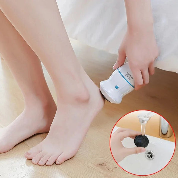 Electric Callus Remover For Feet - Pkwebstore