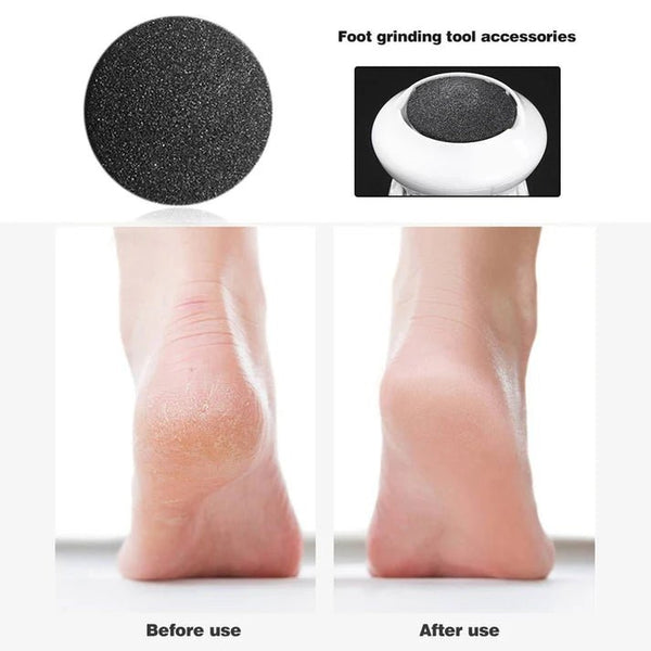 Electric Callus Remover For Feet - Pkwebstore